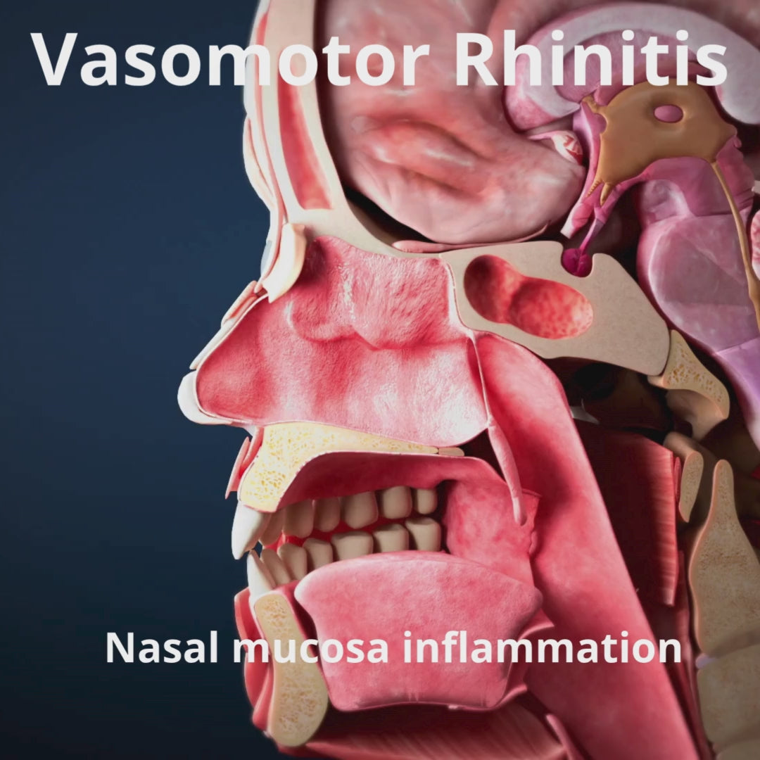 Video laden: Celmast Nasenspray - Kinder