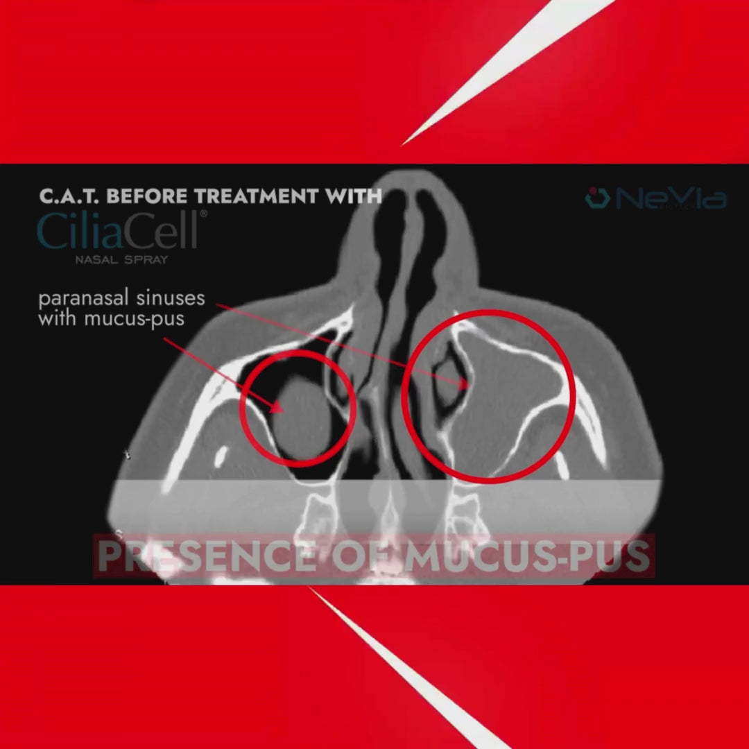 Load video: CiliaCell Nasal Spray - Children
